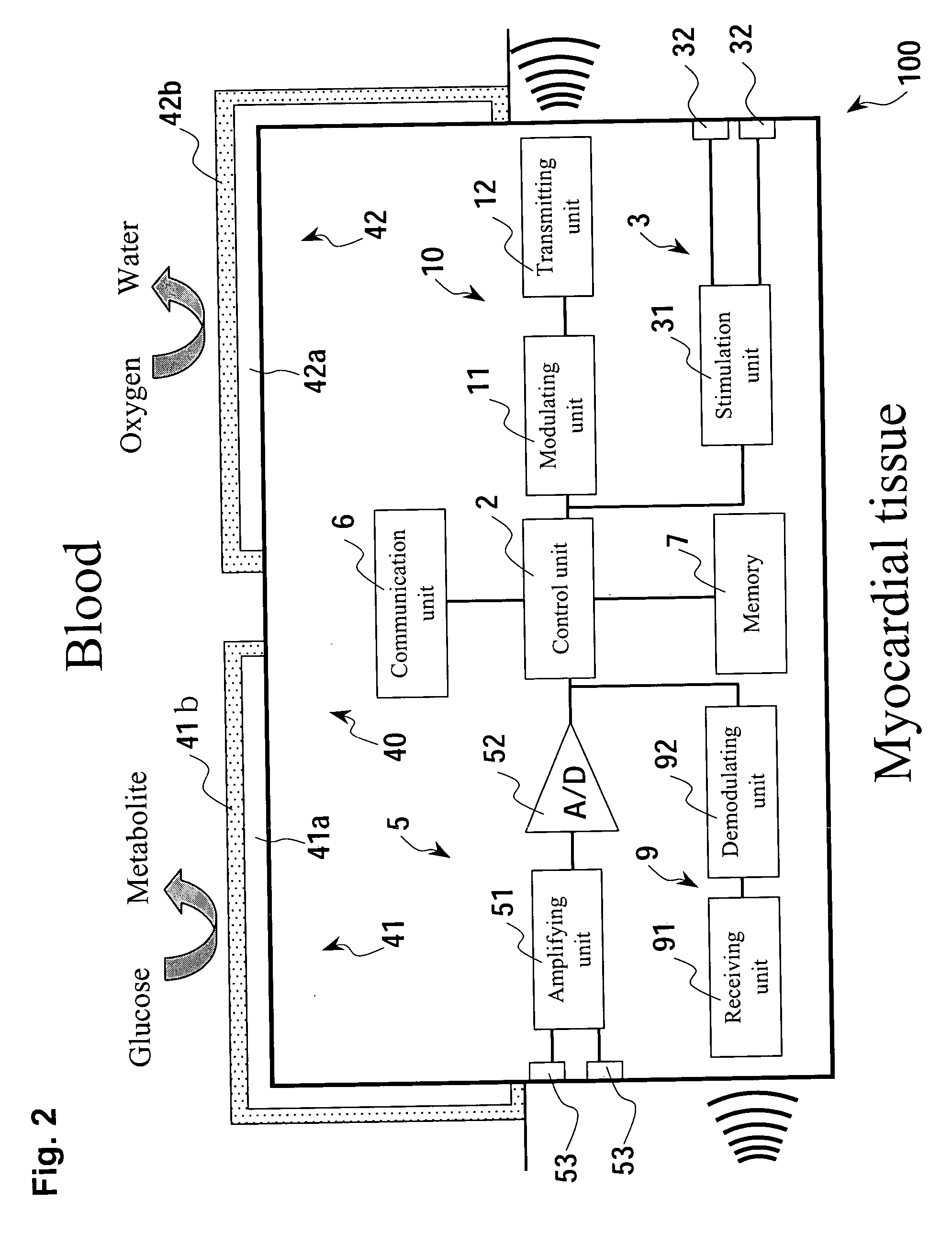 Micro integrated cardiac pacemaker and distributed cardiac pacing system