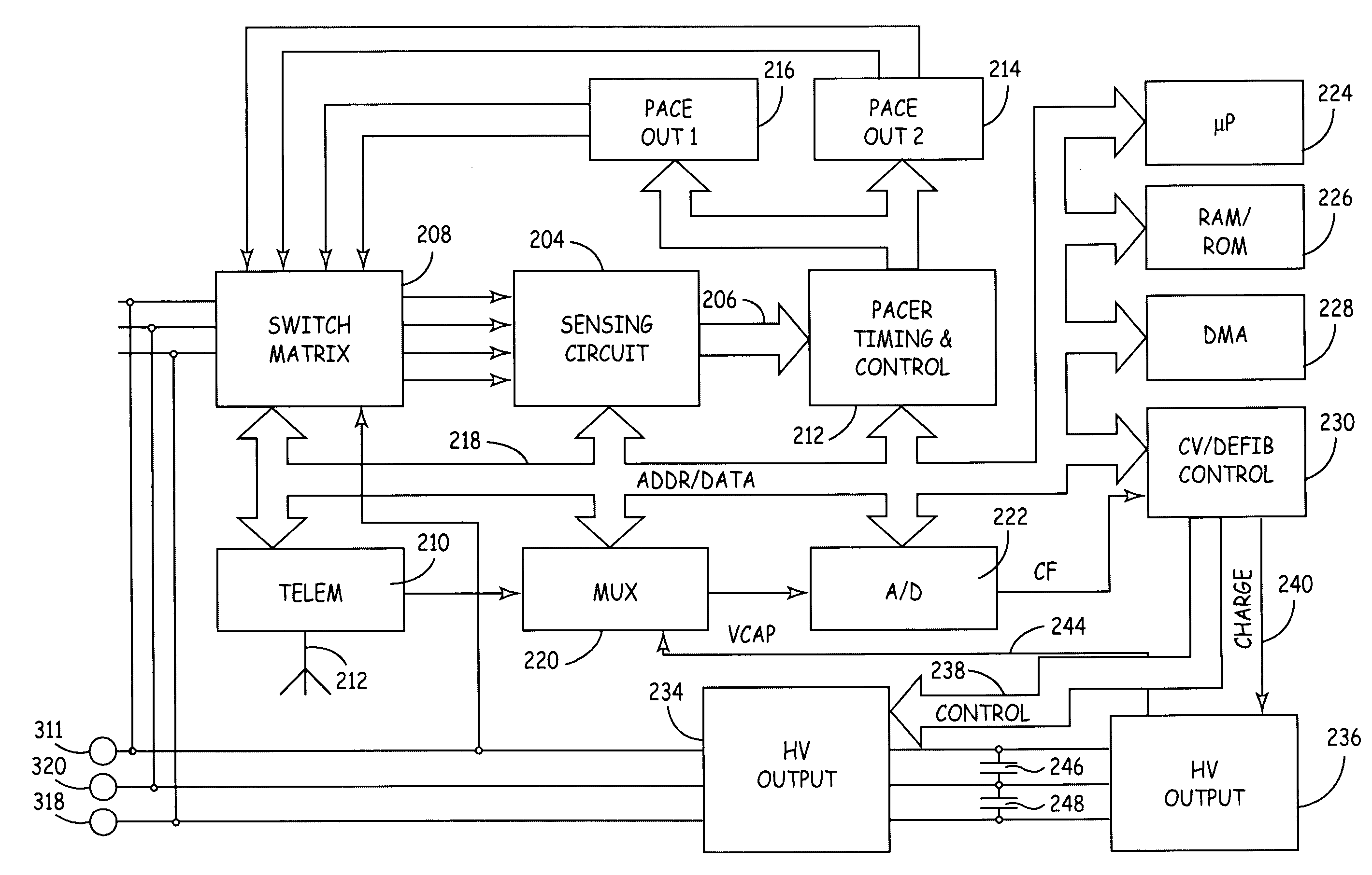 Method and apparatus for arrhythmia detection in a medical device