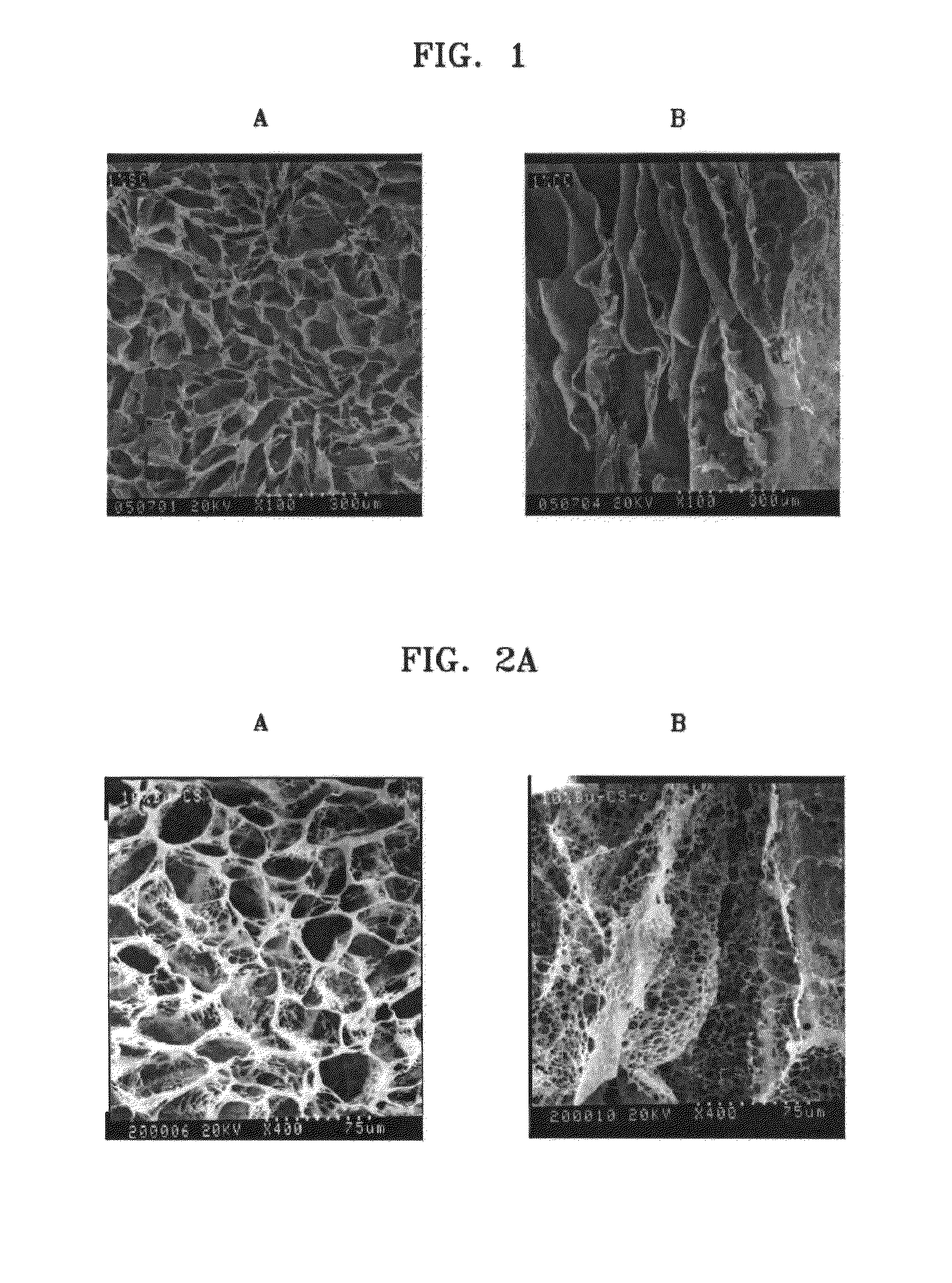 Method of producing chitosan scaffold having high tensile strength and chitosan scaffold produced using the method