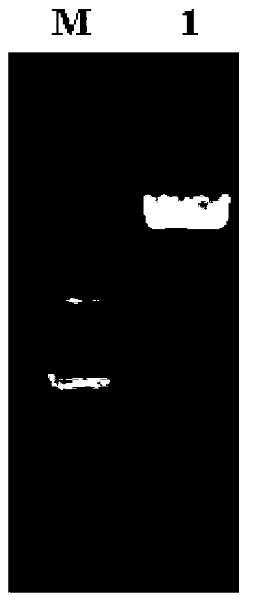 Genetic engineering bacterium expressing snake venom kininogenase as well as constructing method and application thereof