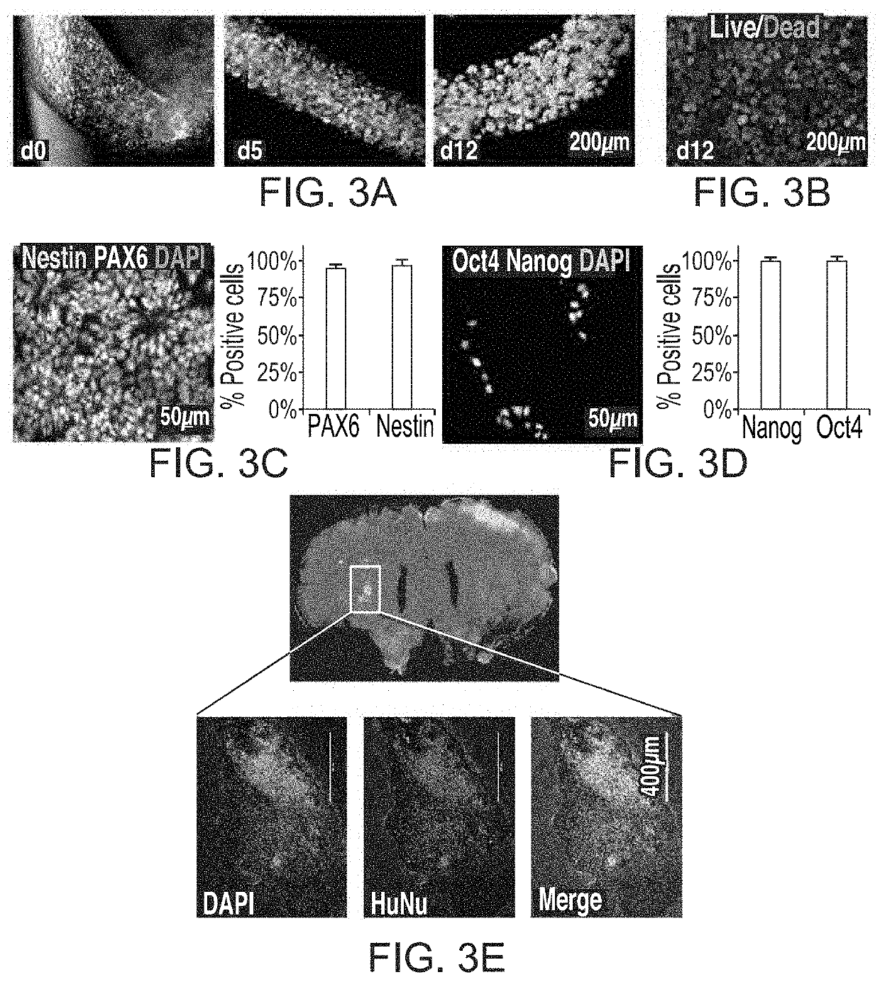 Personalized cellular biomanufacturing with a closed, miniature cell culture system