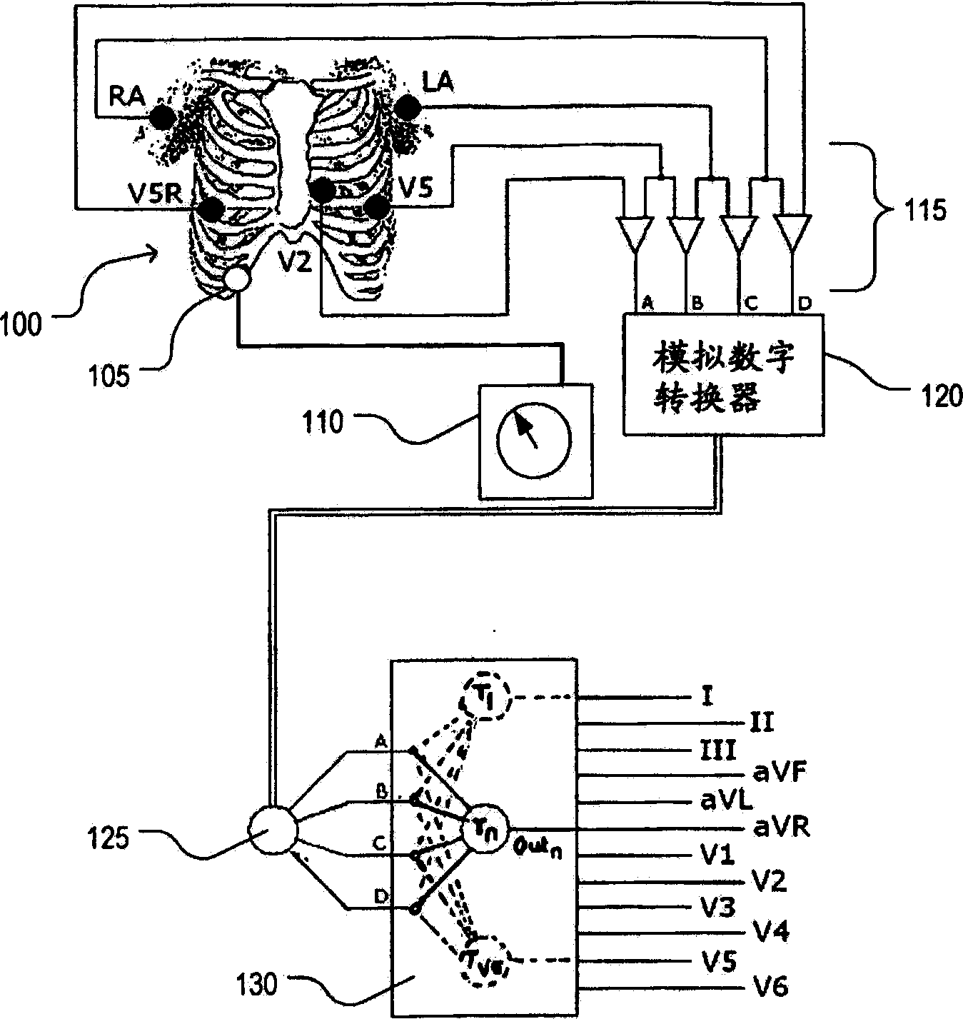 Reduced electrode electrocardiography system