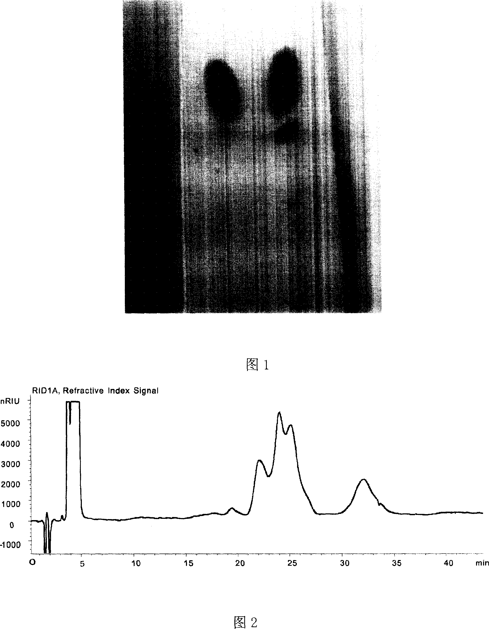 Prepn process of iodized plant ethyl oleate