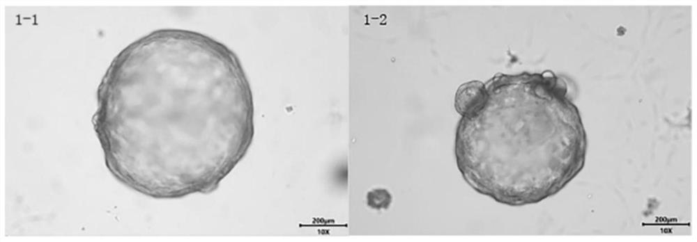 A kind of animal lung bud organoid culture medium and culture method