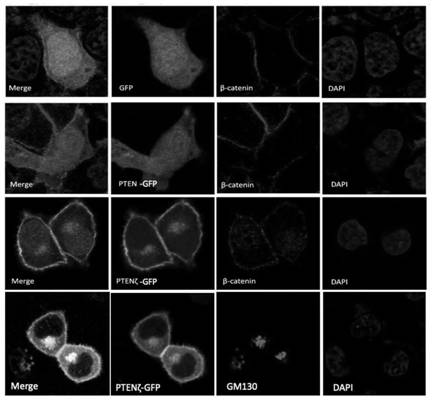 A kind of n-terminal extended type pten subtype ptenζ protein and its coding gene and application