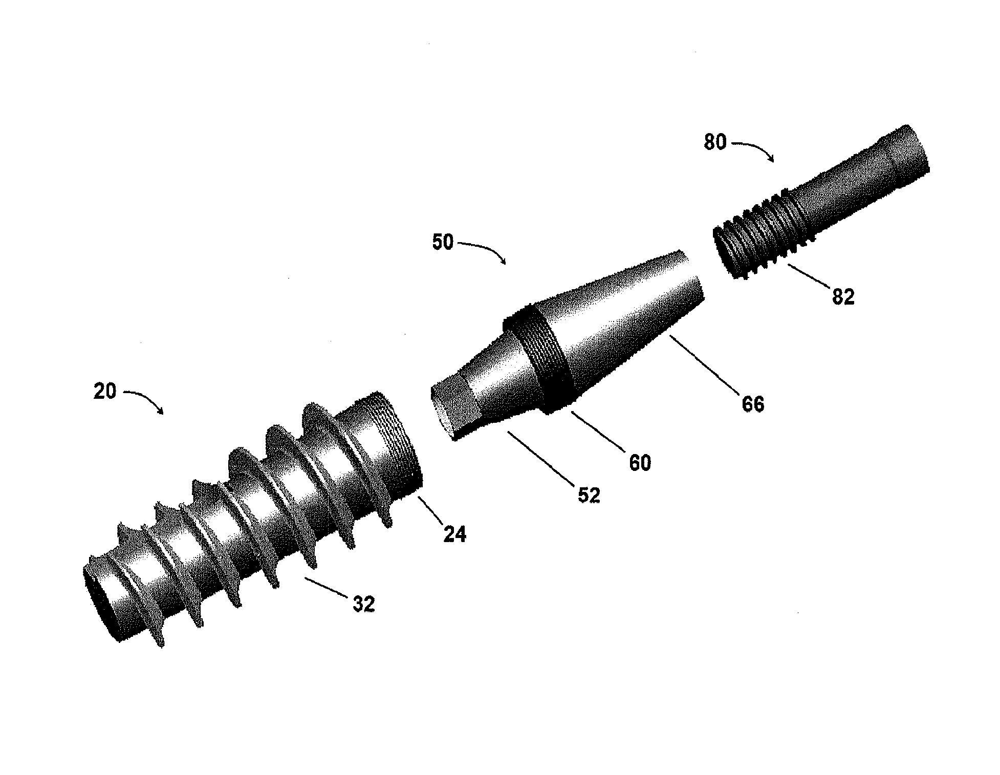 High torque dental implant system