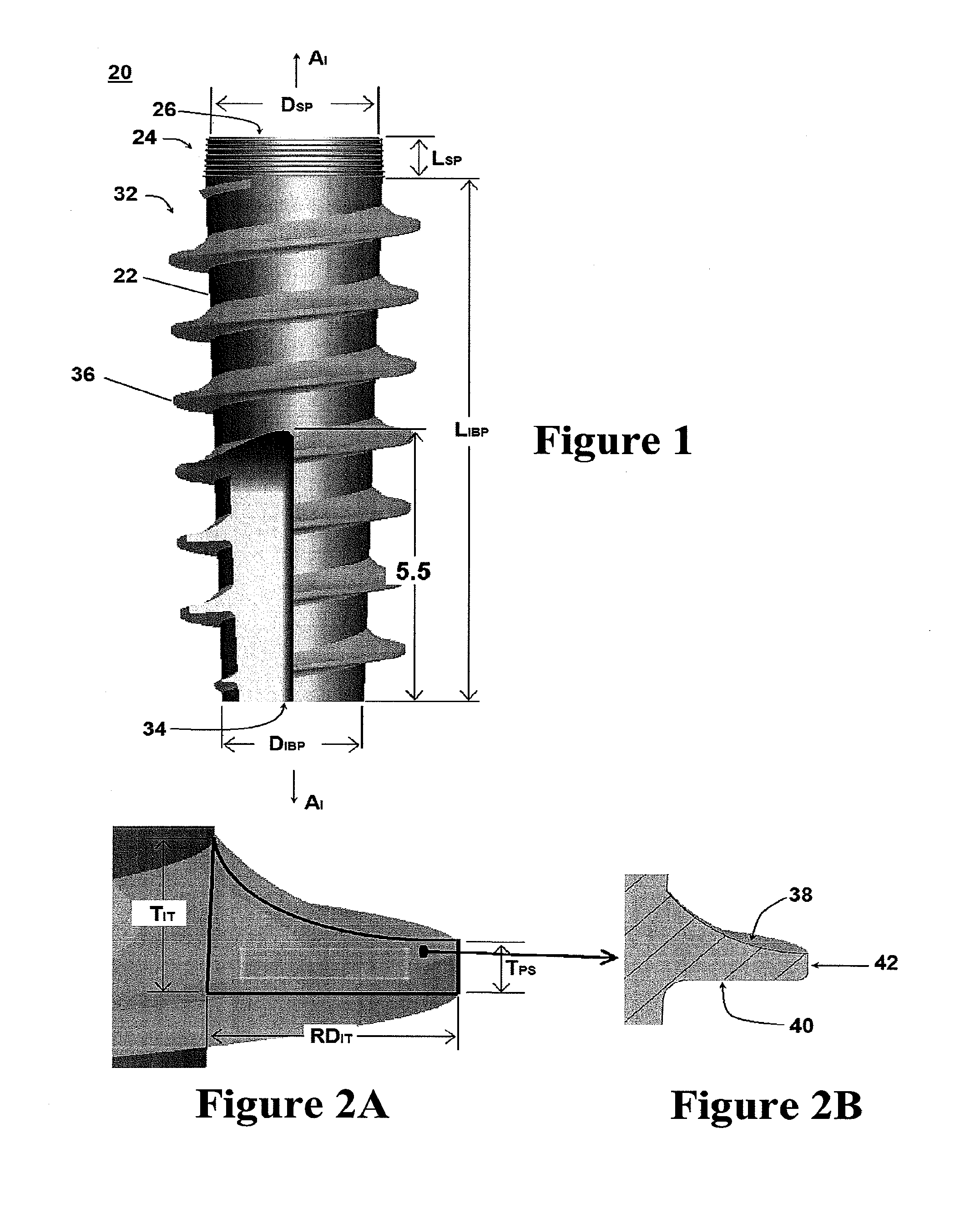 High torque dental implant system