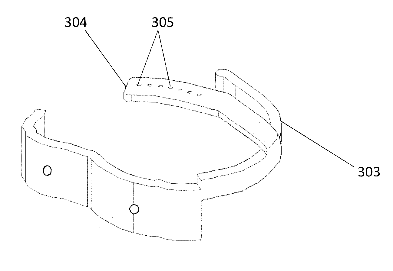 Patient specific soft tissue protectors and retractors