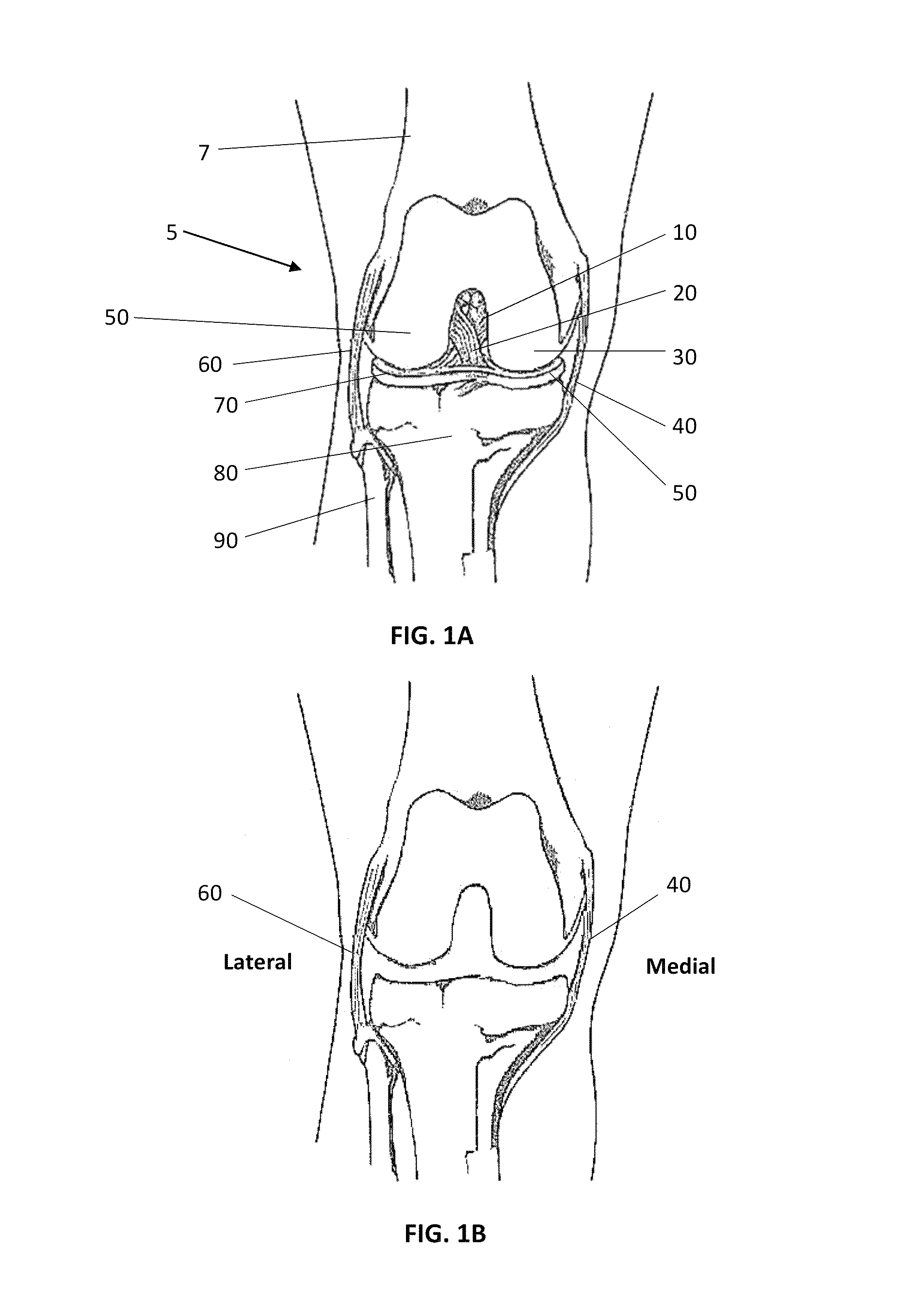 Patient specific soft tissue protectors and retractors