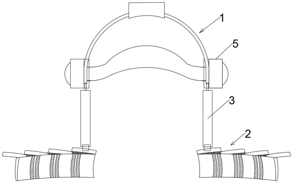 An intelligent self-adaptive recovery fixation device after thyroidectomy