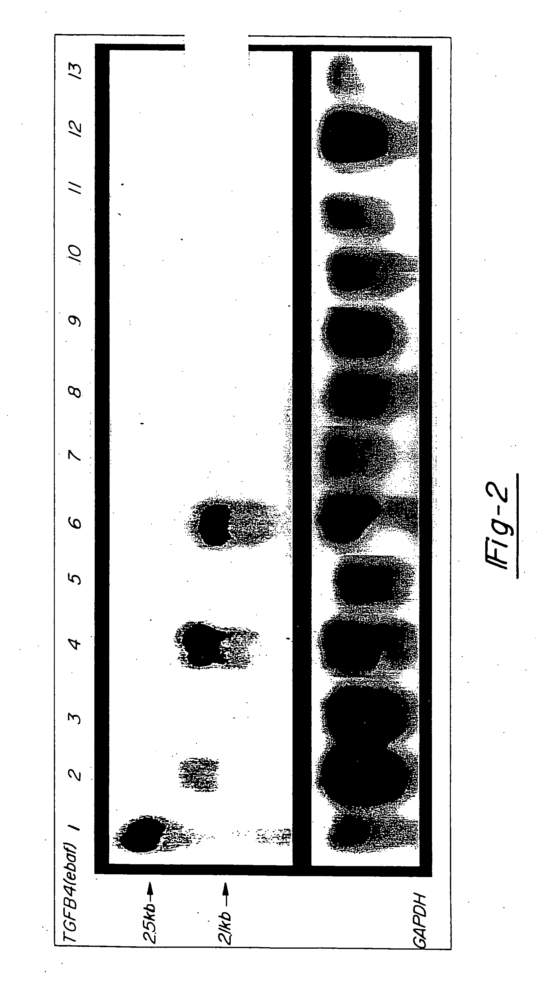 Method for diagnosing selected adenocarcinomas