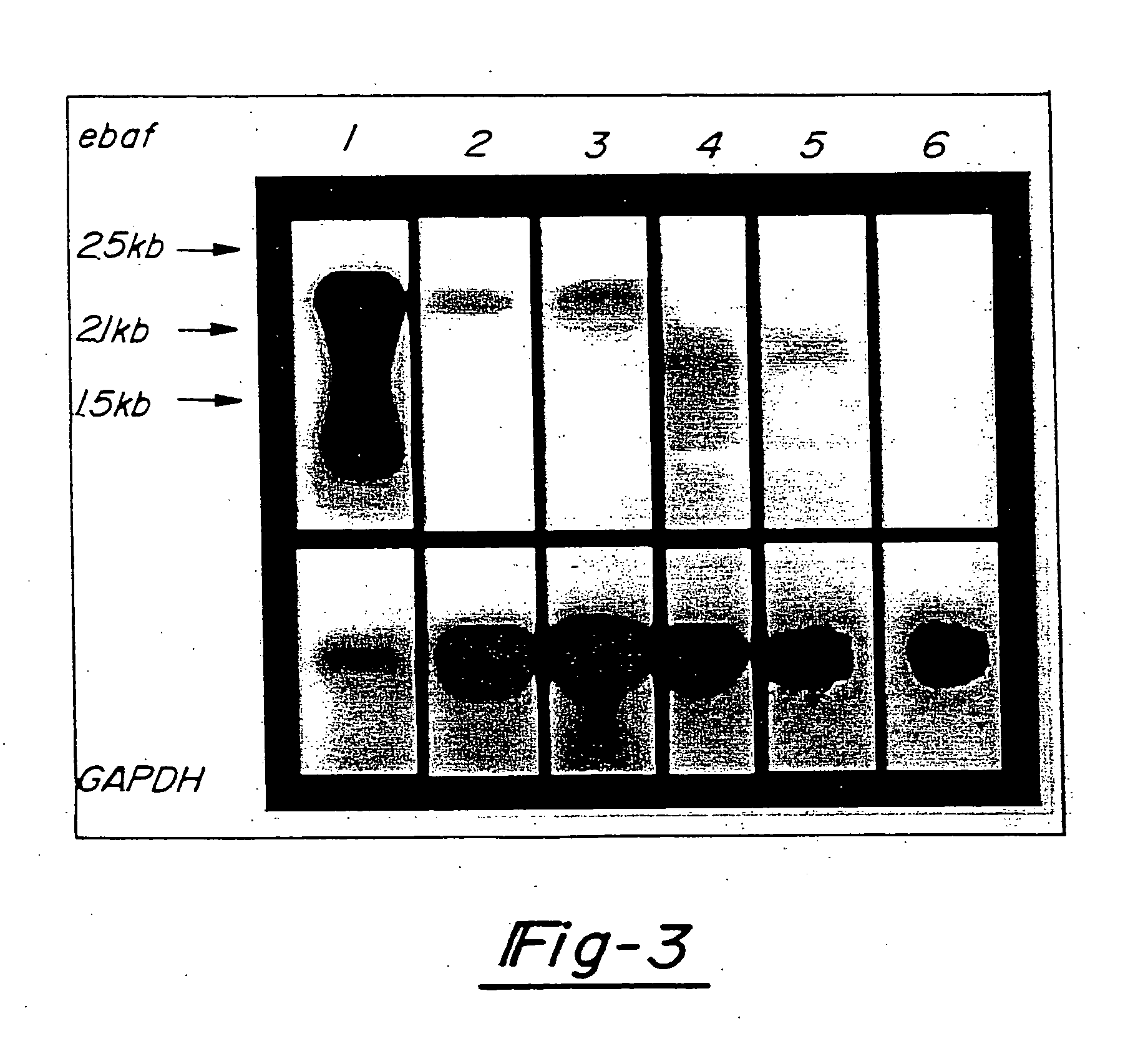 Method for diagnosing selected adenocarcinomas