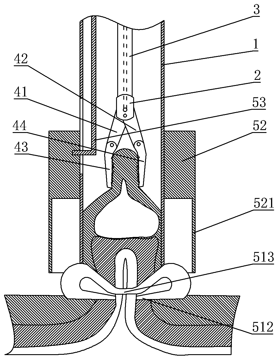 Full-thickness excising device