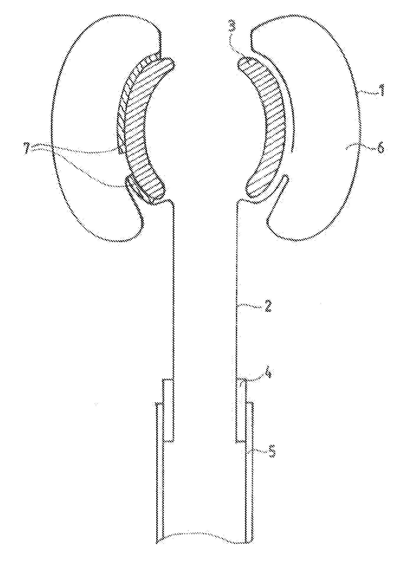 Device for stool drainage