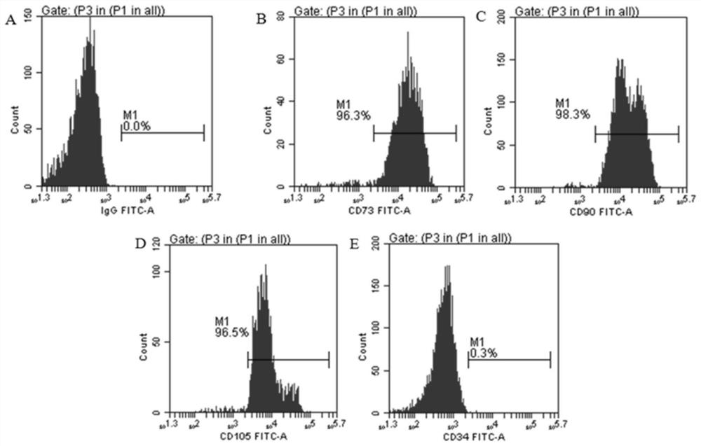 Umbilical cord mesenchymal stem cells silenced by mir338 gene and its preparation method and application