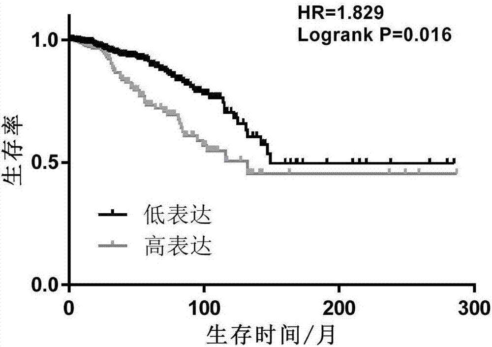 Breast cancer marker and application thereof