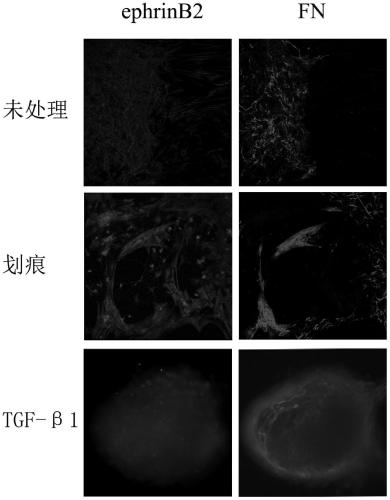 An in vitro glial scar formation model and its construction method and application