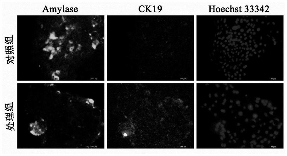 A method for constructing a co-culture system of pancreatic ductal epithelial cells and pancreatic acinar cells simulating the in vivo microenvironment