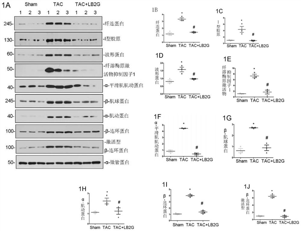 Application of a kind of benzimidazole derivative in the preparation of medicine for treating heart failure