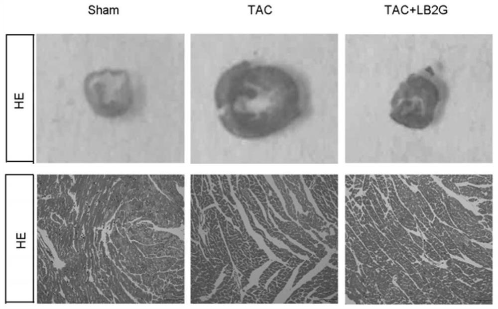 Application of a kind of benzimidazole derivative in the preparation of medicine for treating heart failure