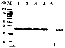 Construction and application of anti-sclerotinia sclerotiorum gene GmPR5 and GmPR5 transgenic plant