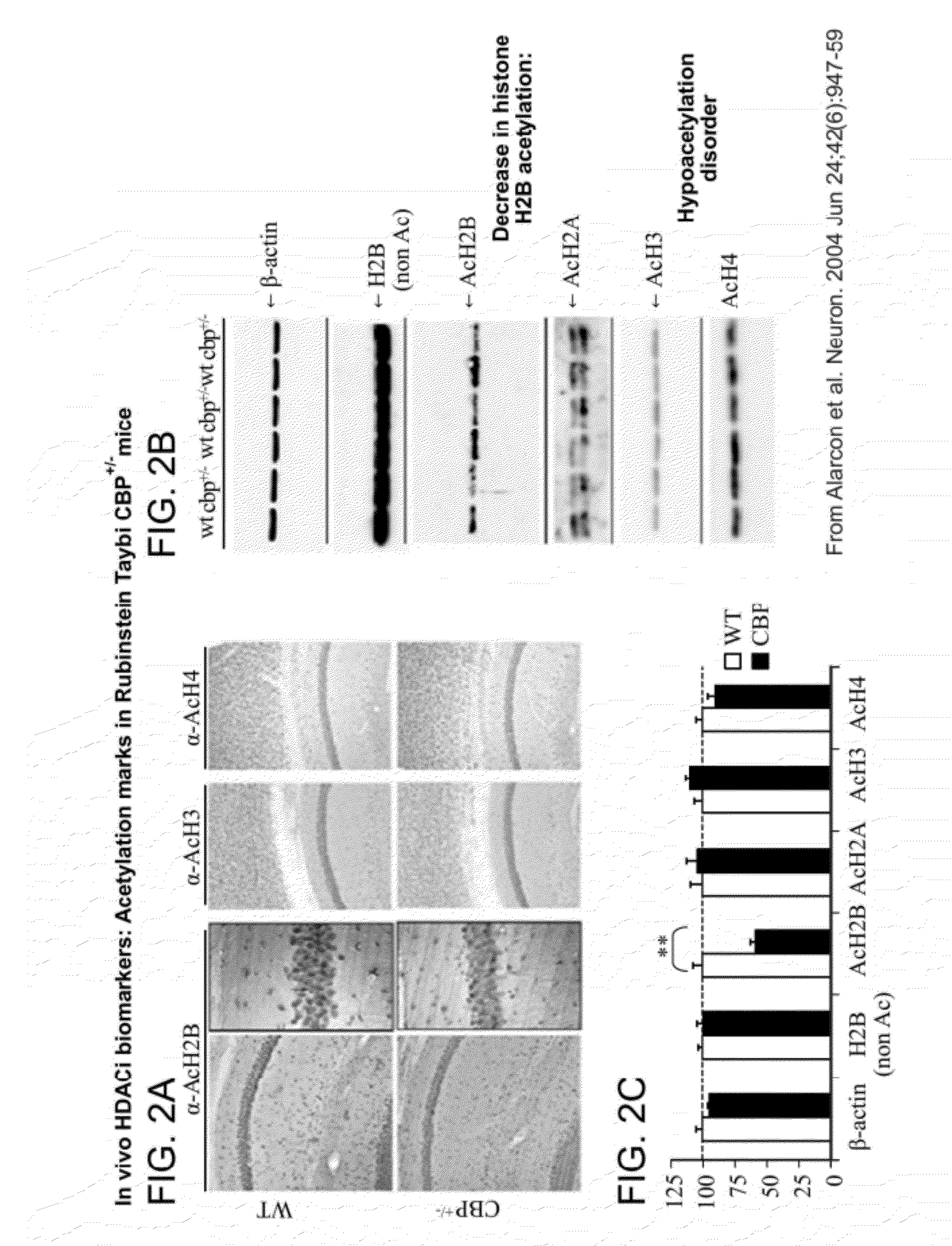 Use of ci-994 and dinaline for the treatment of memory/cognition and anxiety disorders