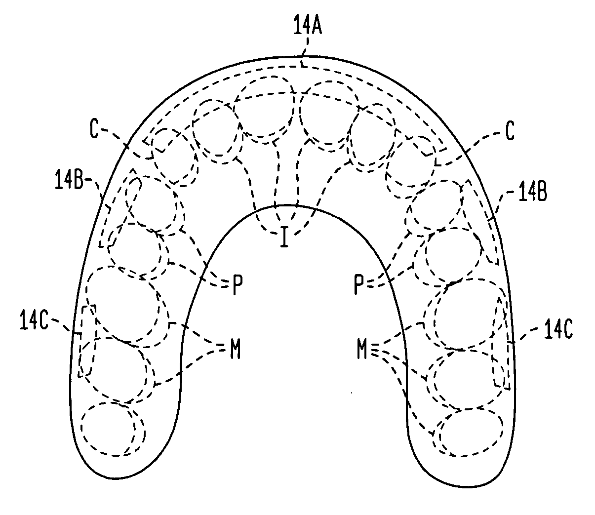 Inserts for use with oral appliances