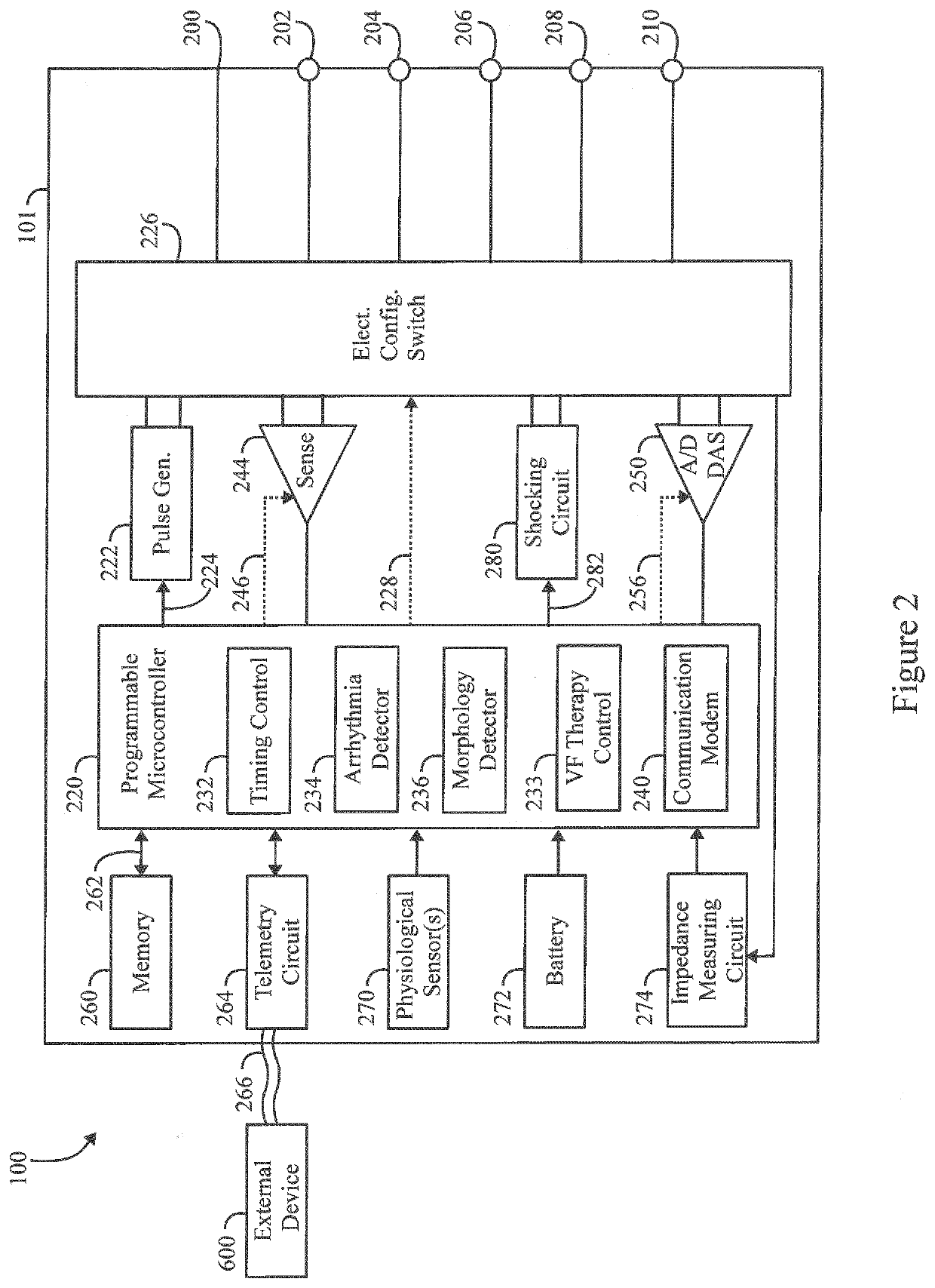 Method and device for monitoring left ventricular hypertrophy and calculating defibrillation thresholds