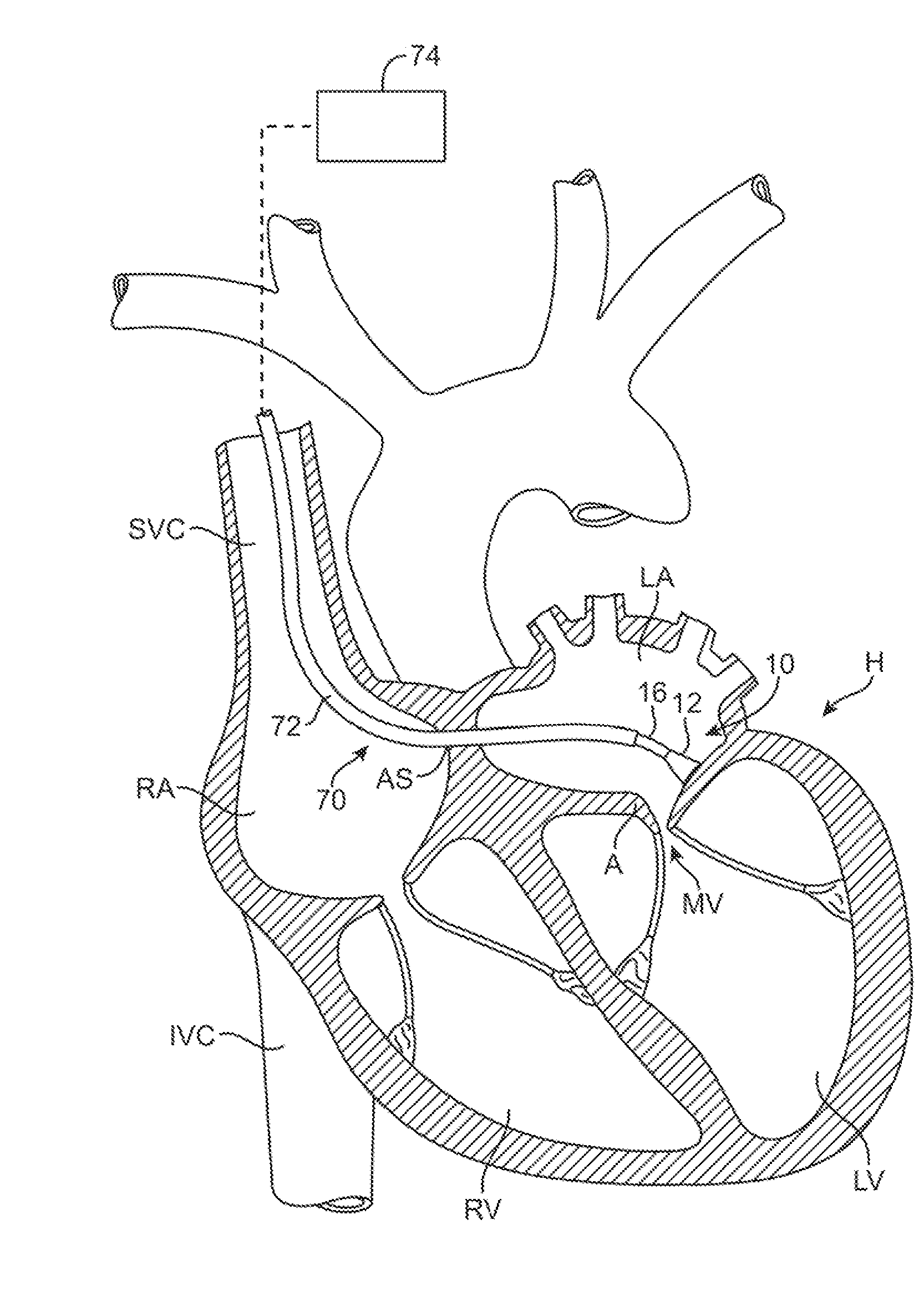 Visual electrode ablation systems