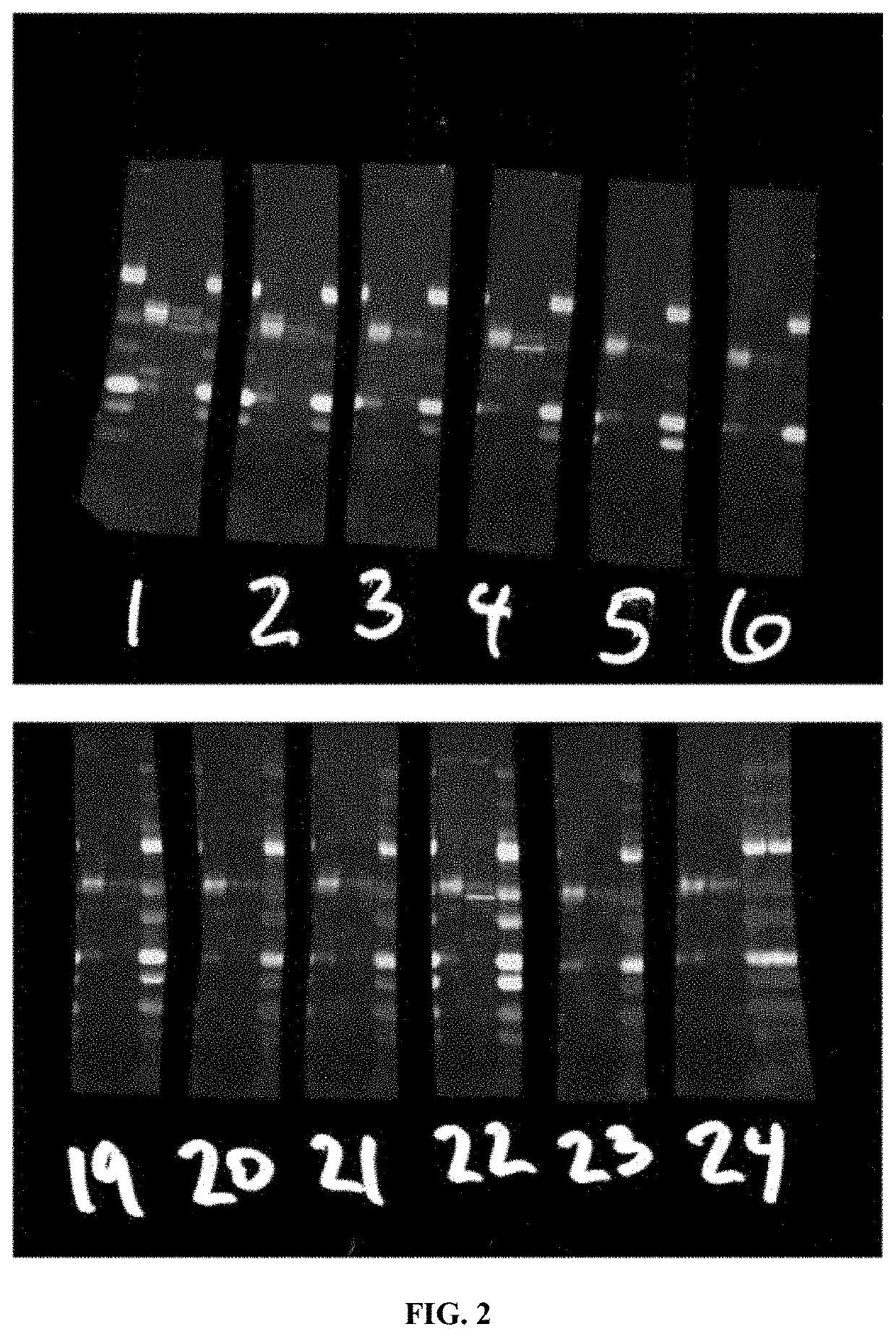 Antibodies for binding pathologic forms of calcineurin