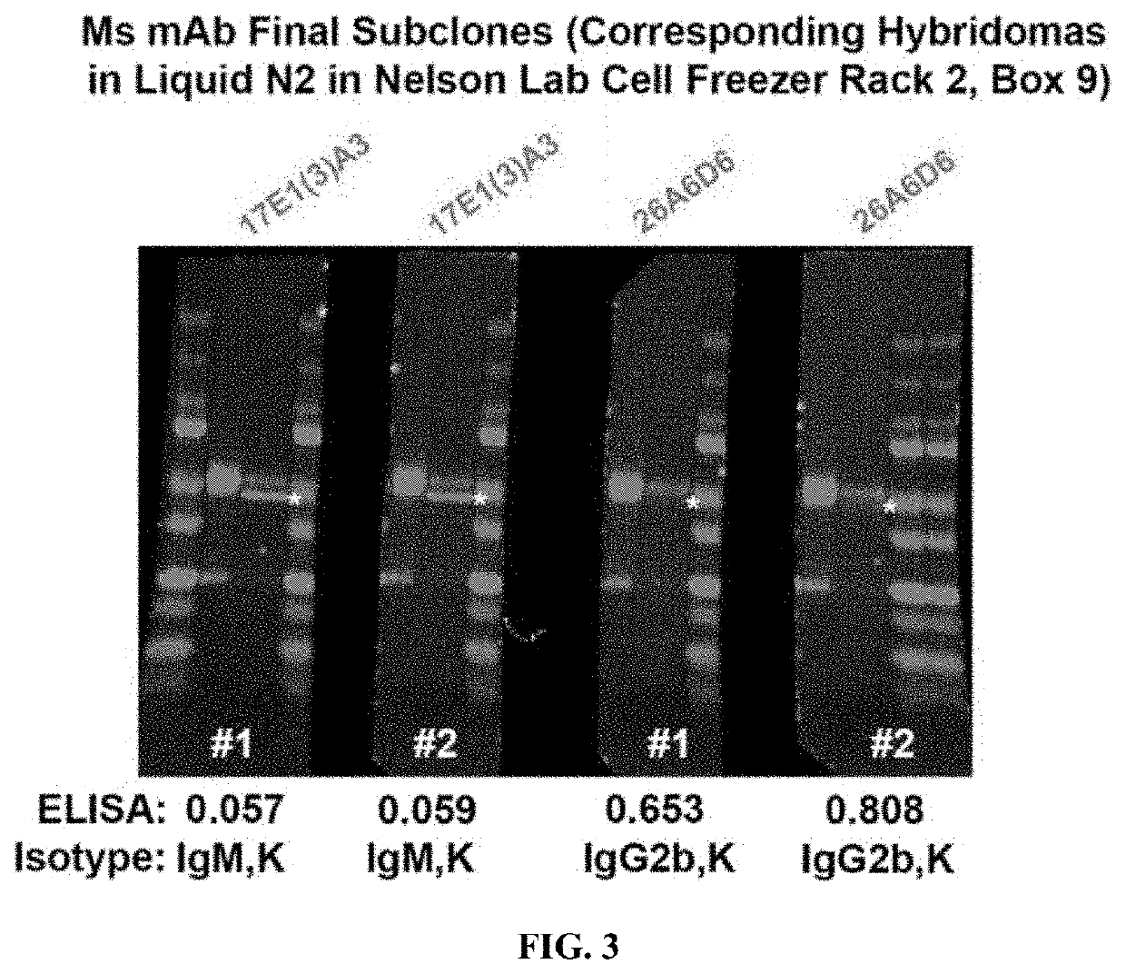 Antibodies for binding pathologic forms of calcineurin