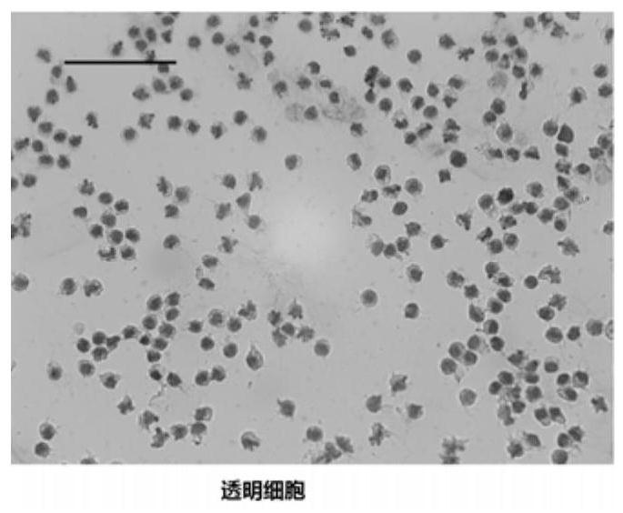 A method for separating blood cells of Portunus trituberculatus