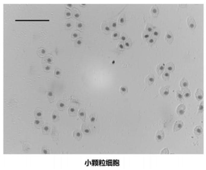 A method for separating blood cells of Portunus trituberculatus