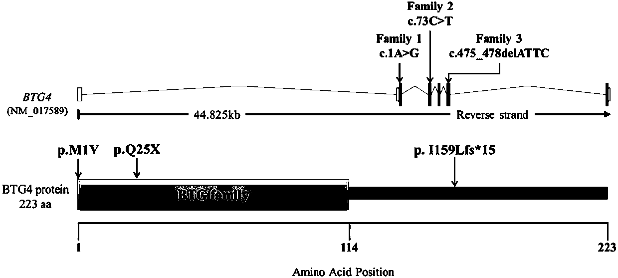 Marker BTG4 gene for judging female primary infertility and detection kit thereof