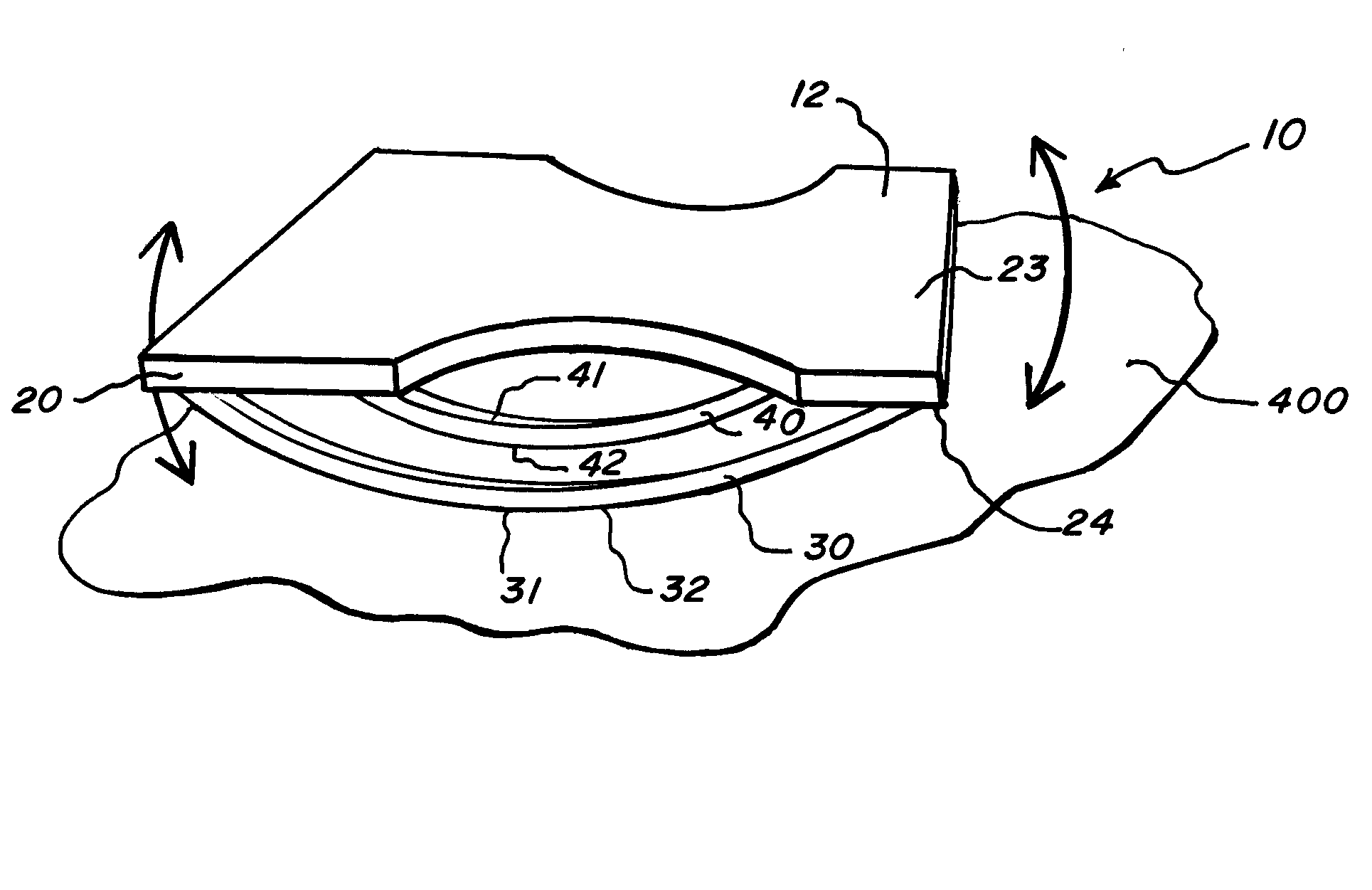 Apparatus and methods for the prevention of venous thromboembolism