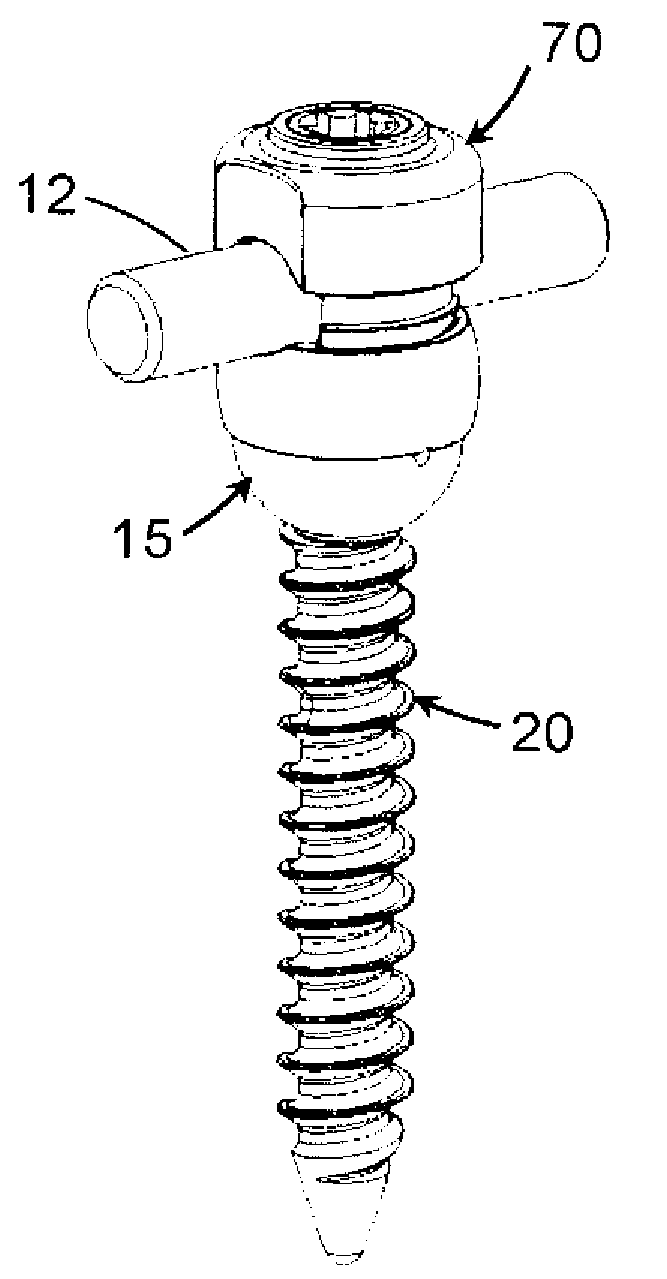 Multi-Axial Spinal Fixation System