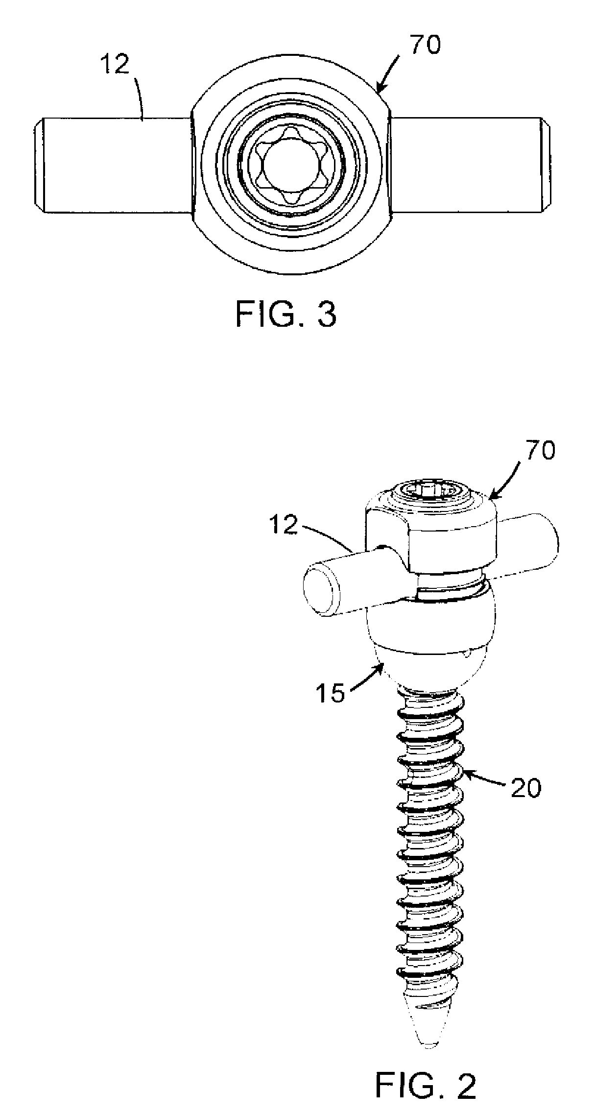 Multi-Axial Spinal Fixation System