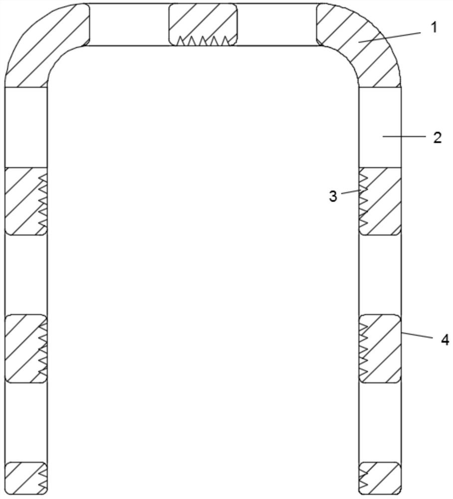 In-vivo absorbable metal anastomosis nail and preparation method thereof