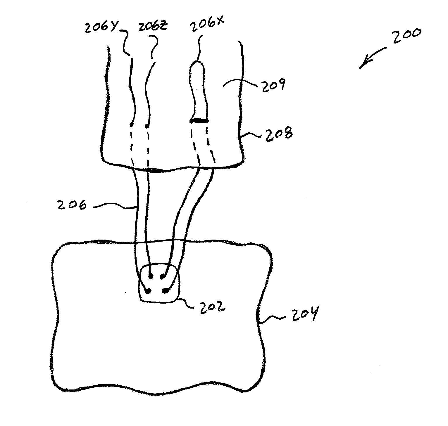 Soft Tissue Fixation Using A Looped Suture Construct