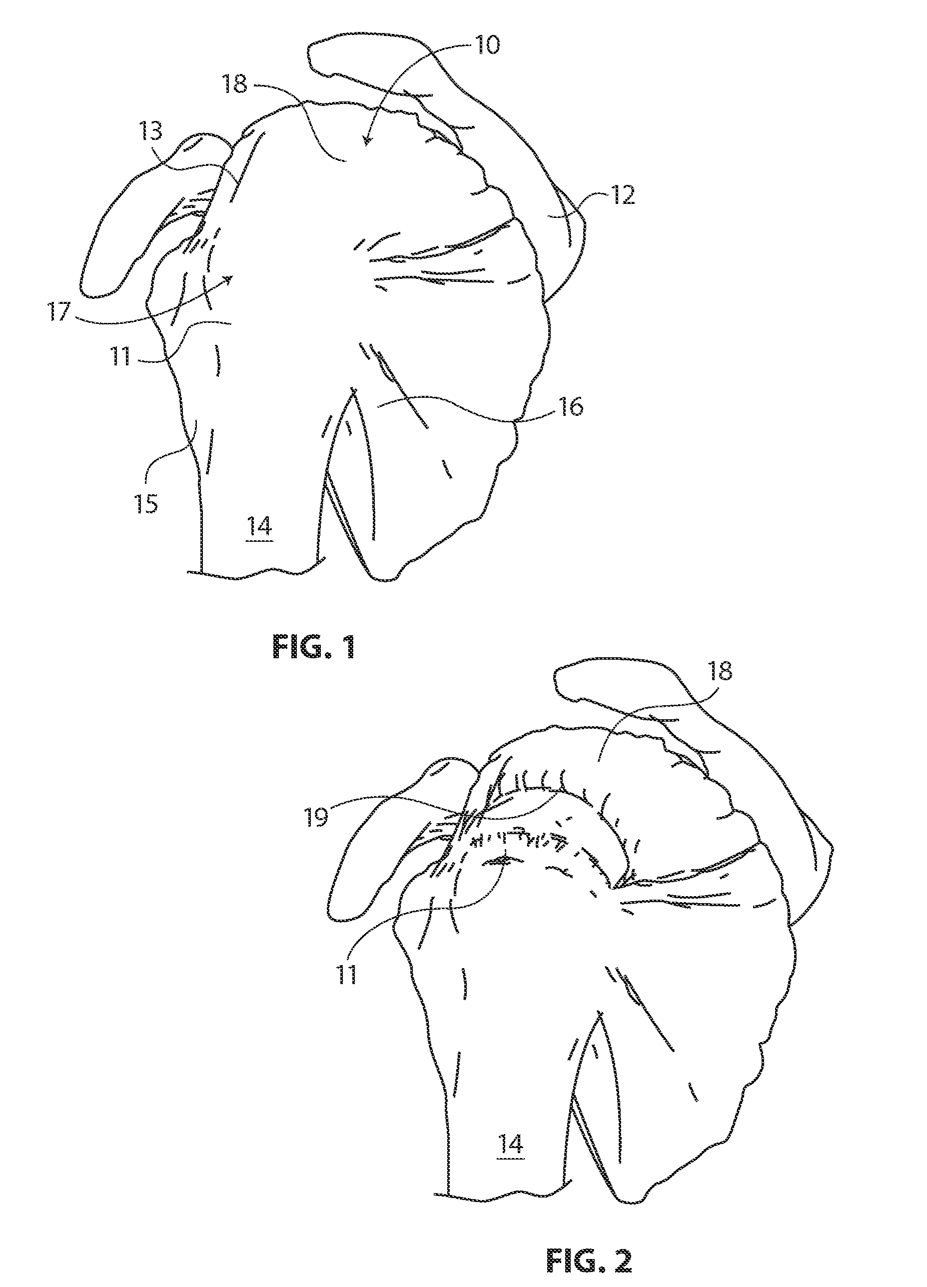 Methods and apparatus for fixing sheet-like materials to a target tissue