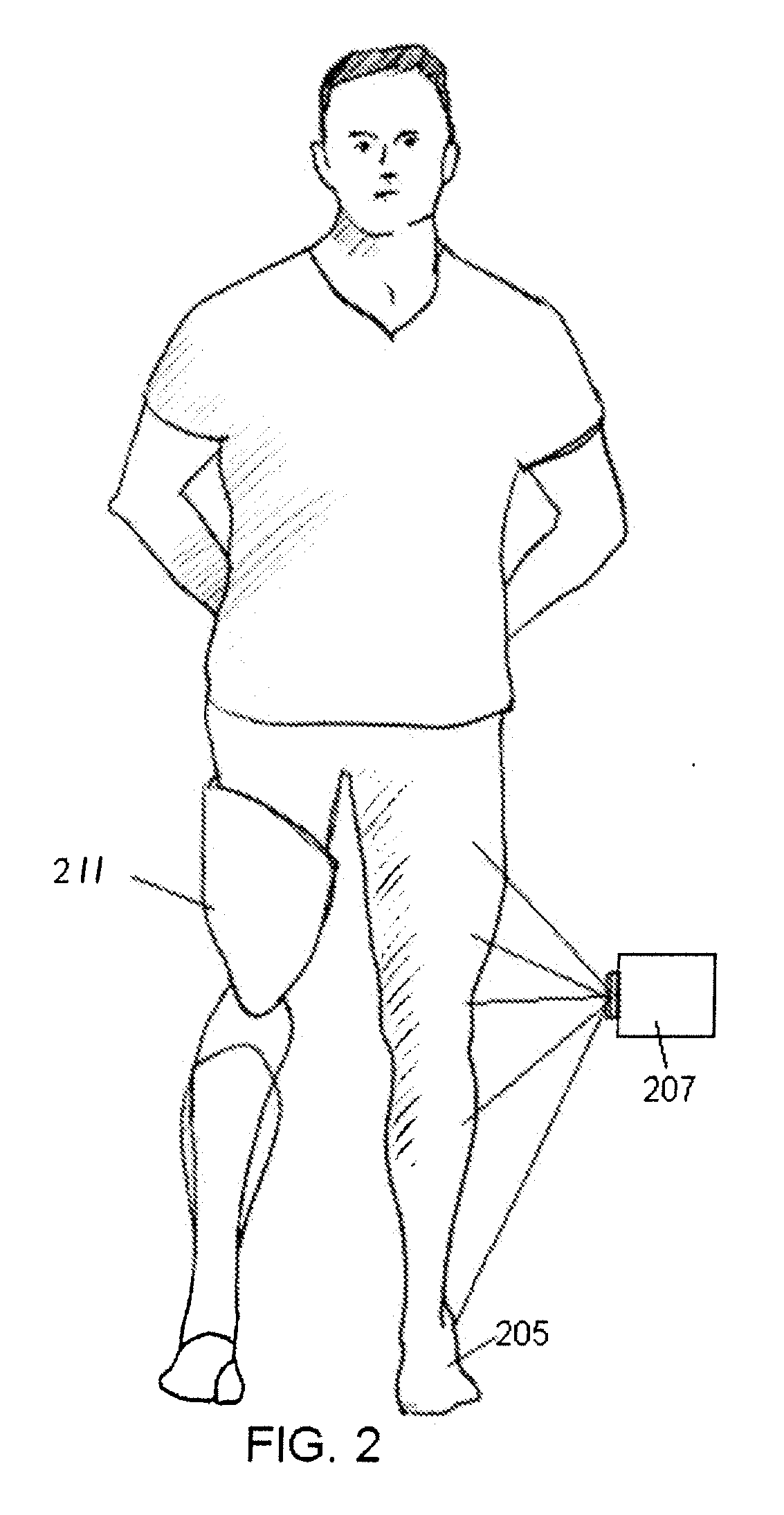 Prosthetic limb