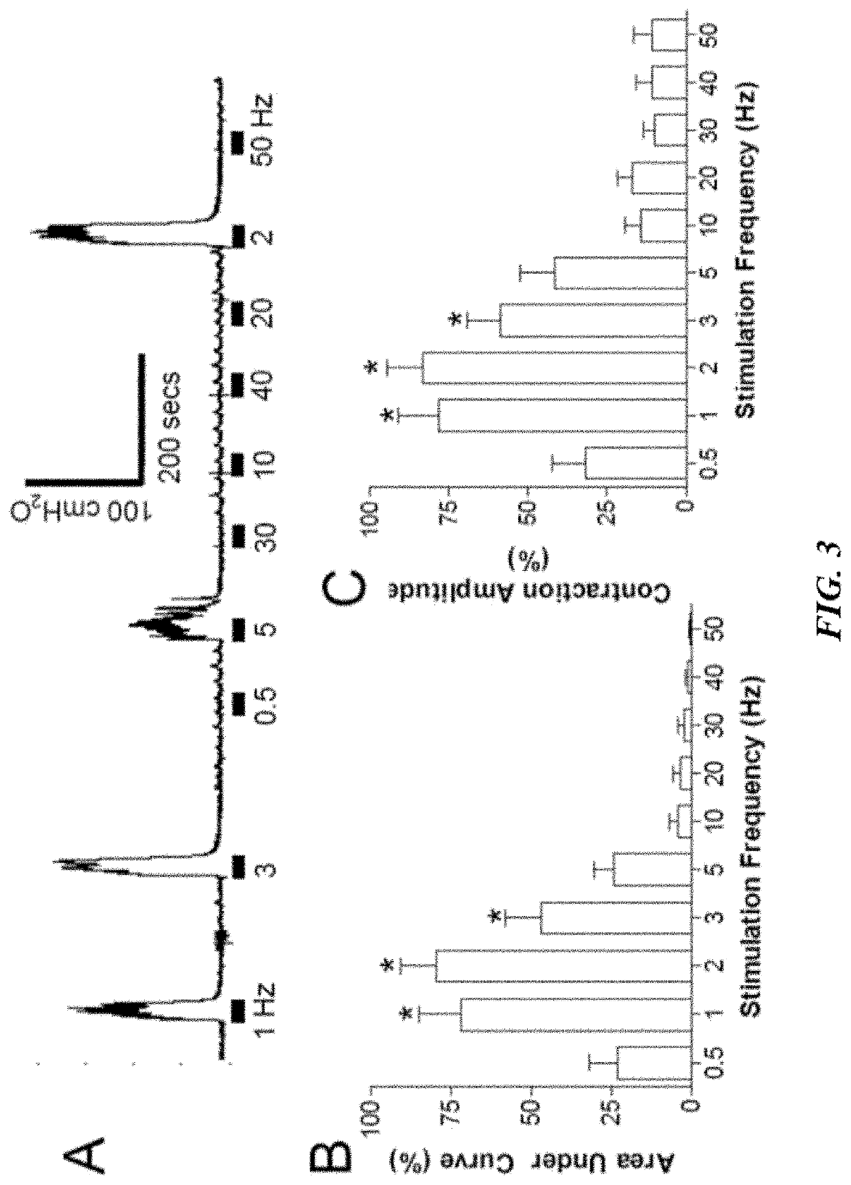 Peripheral Neuromodulation to Treat Bladder and Bowel Dysfunction