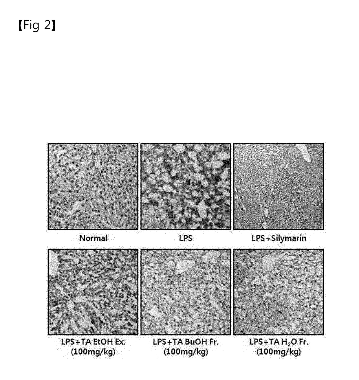 Method for preventing, improving or treating liver disease