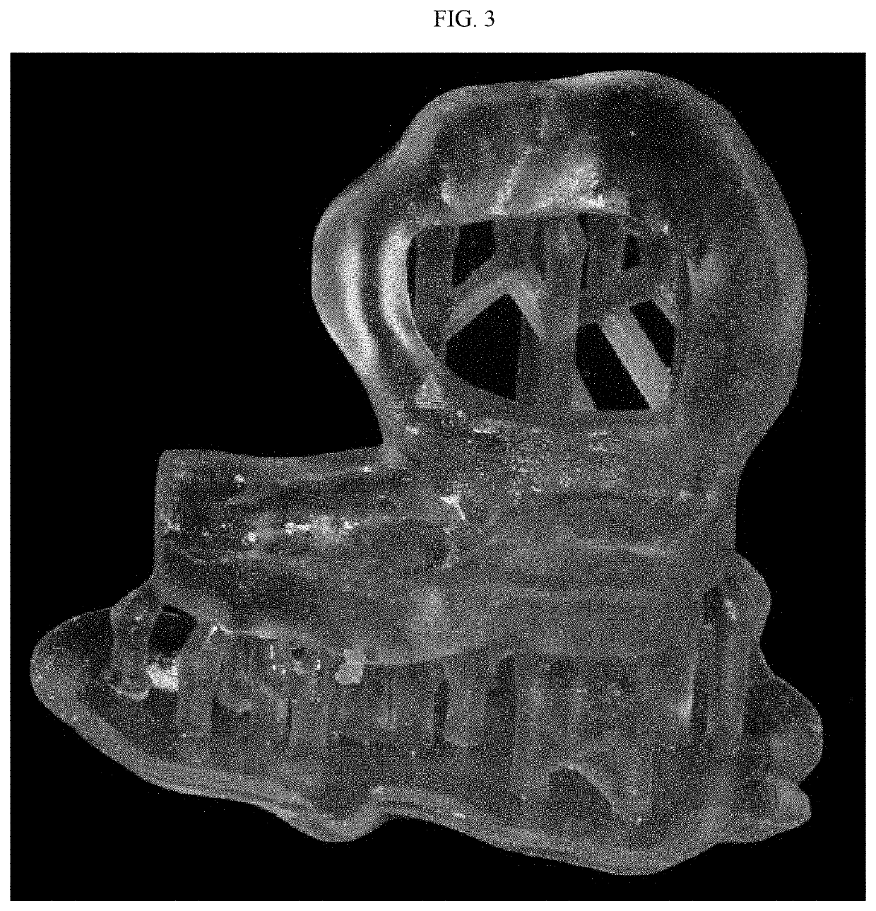 Three-dimensional printed bone supported sinus guide for edentulous maxillary arch