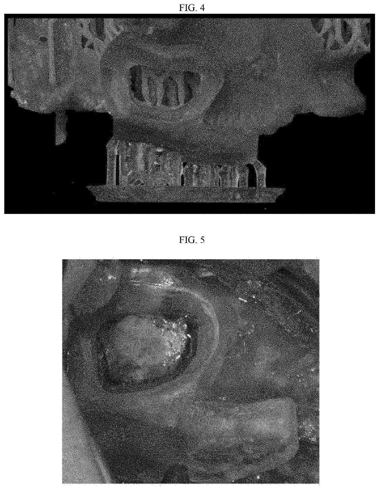 Three-dimensional printed bone supported sinus guide for edentulous maxillary arch