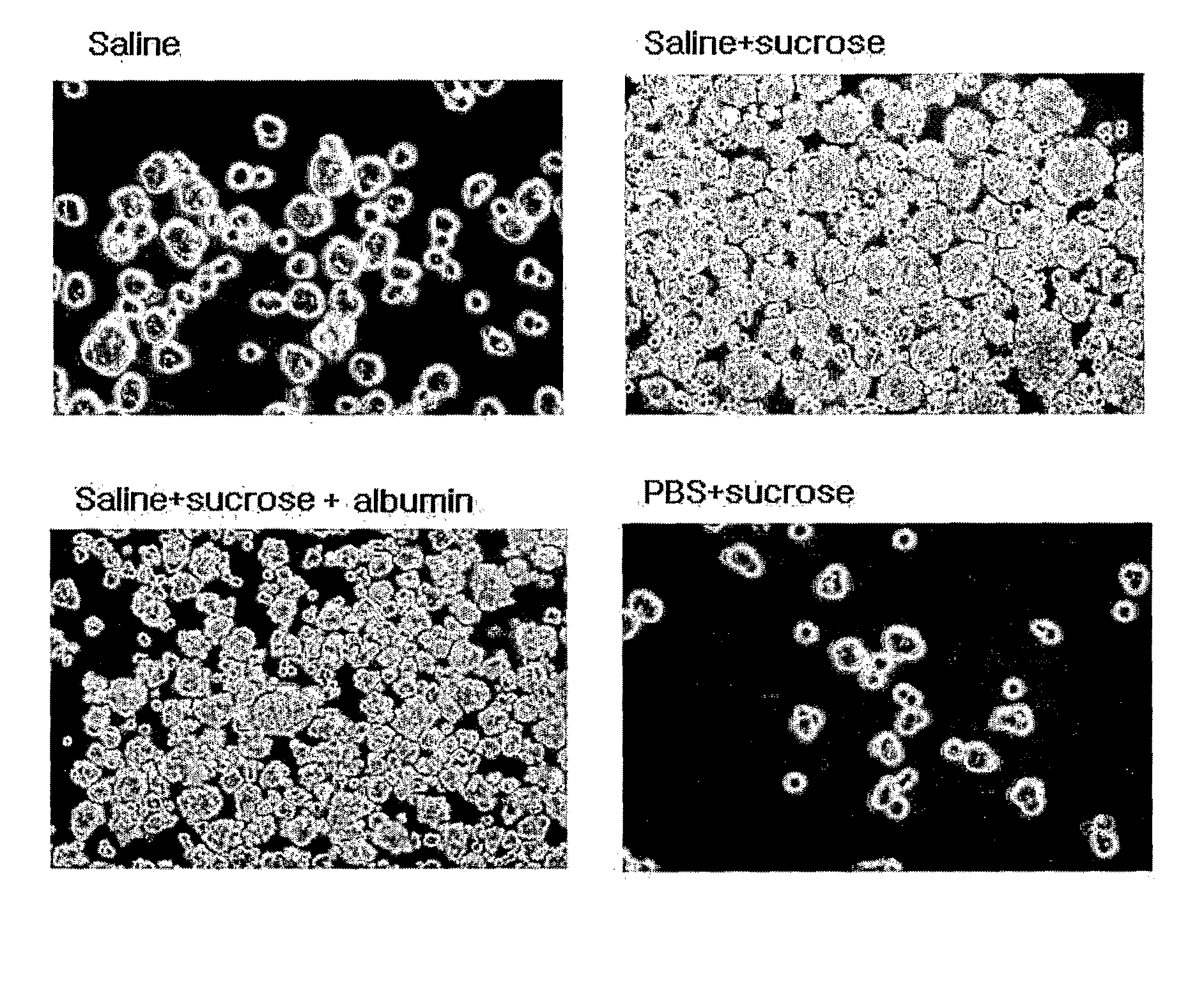 Composition for treating ischemic limb disease comprising stem cells derived from adipose tissue