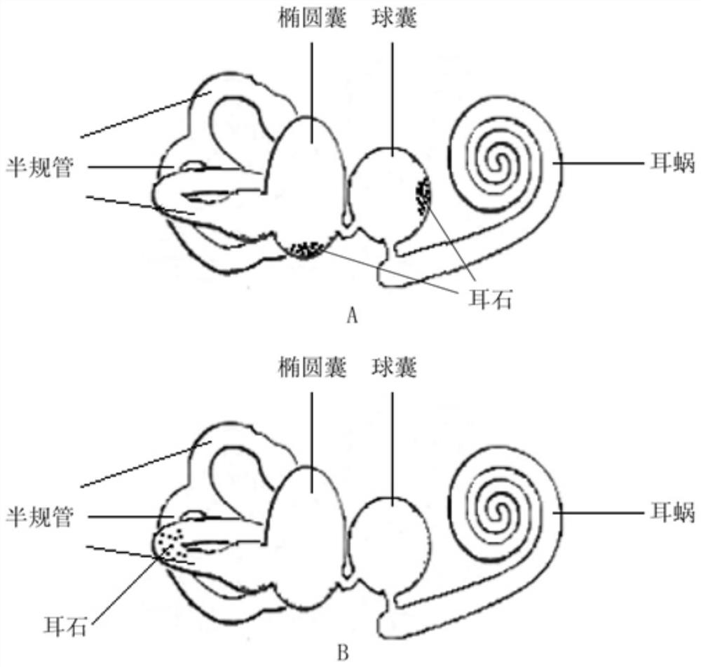 Inner ear balancer demonstration teaching aid