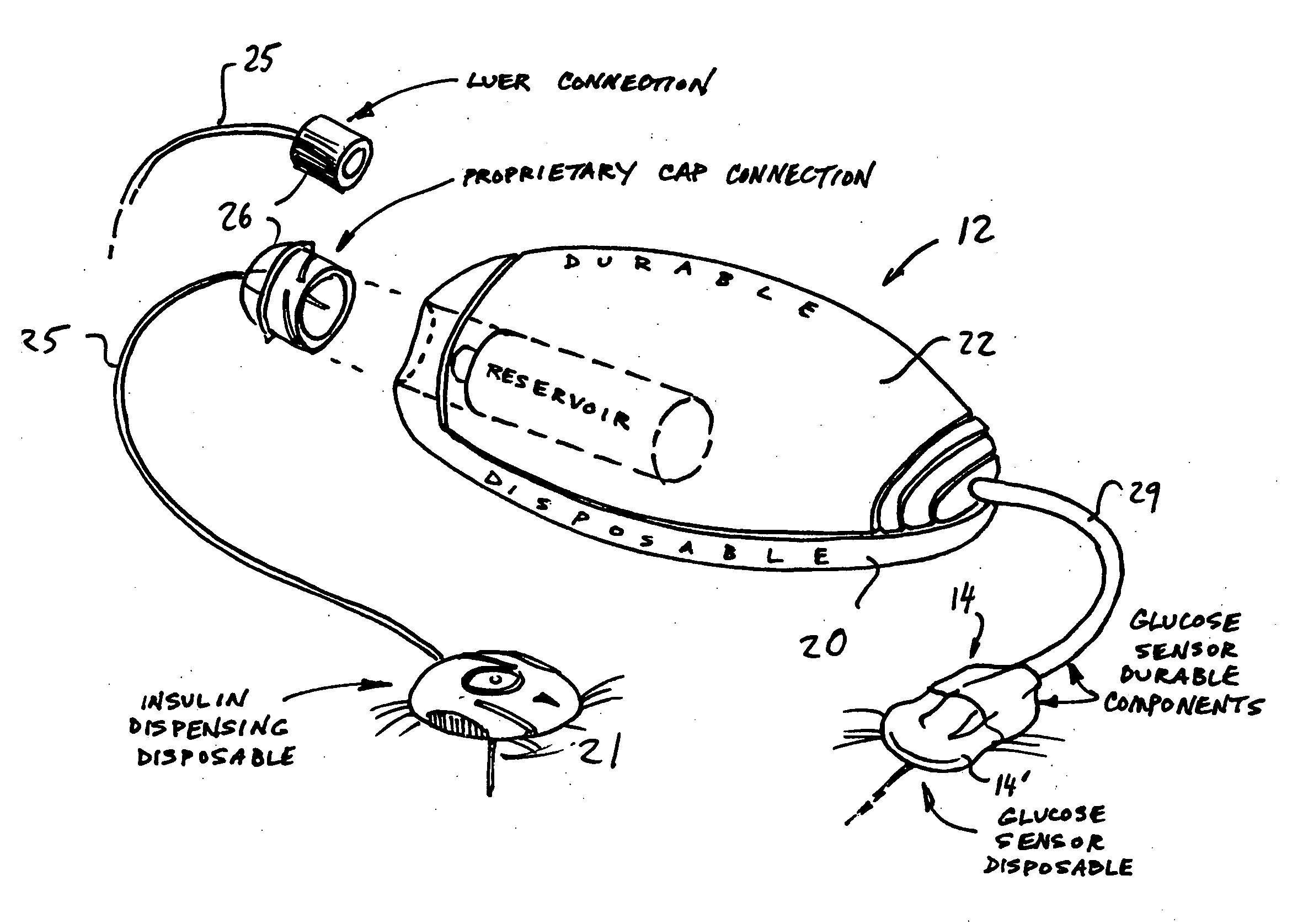 Infusion device and method with disposable portion