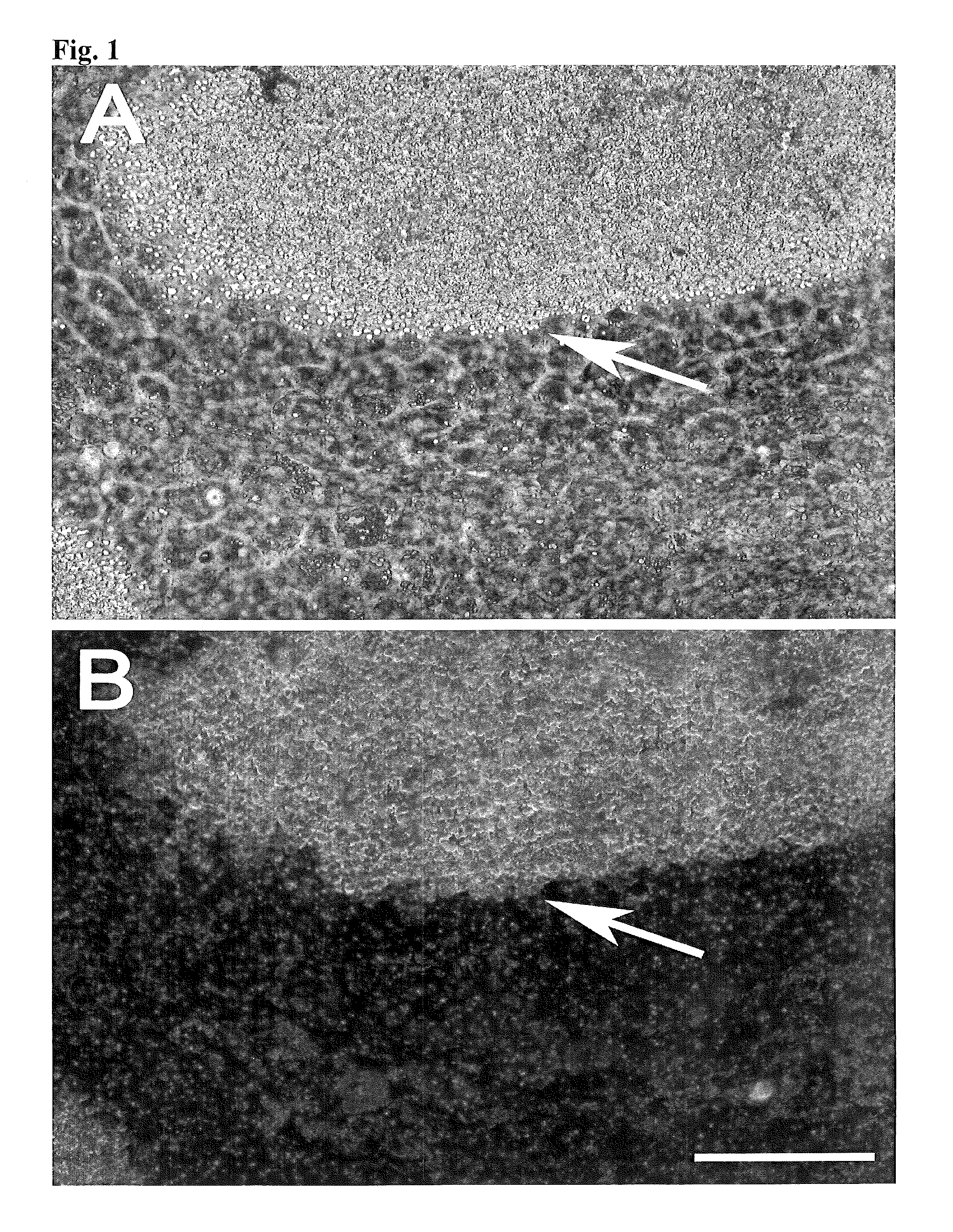 Retinal pigment epithelial primary cell culture system producing subcellular deposits