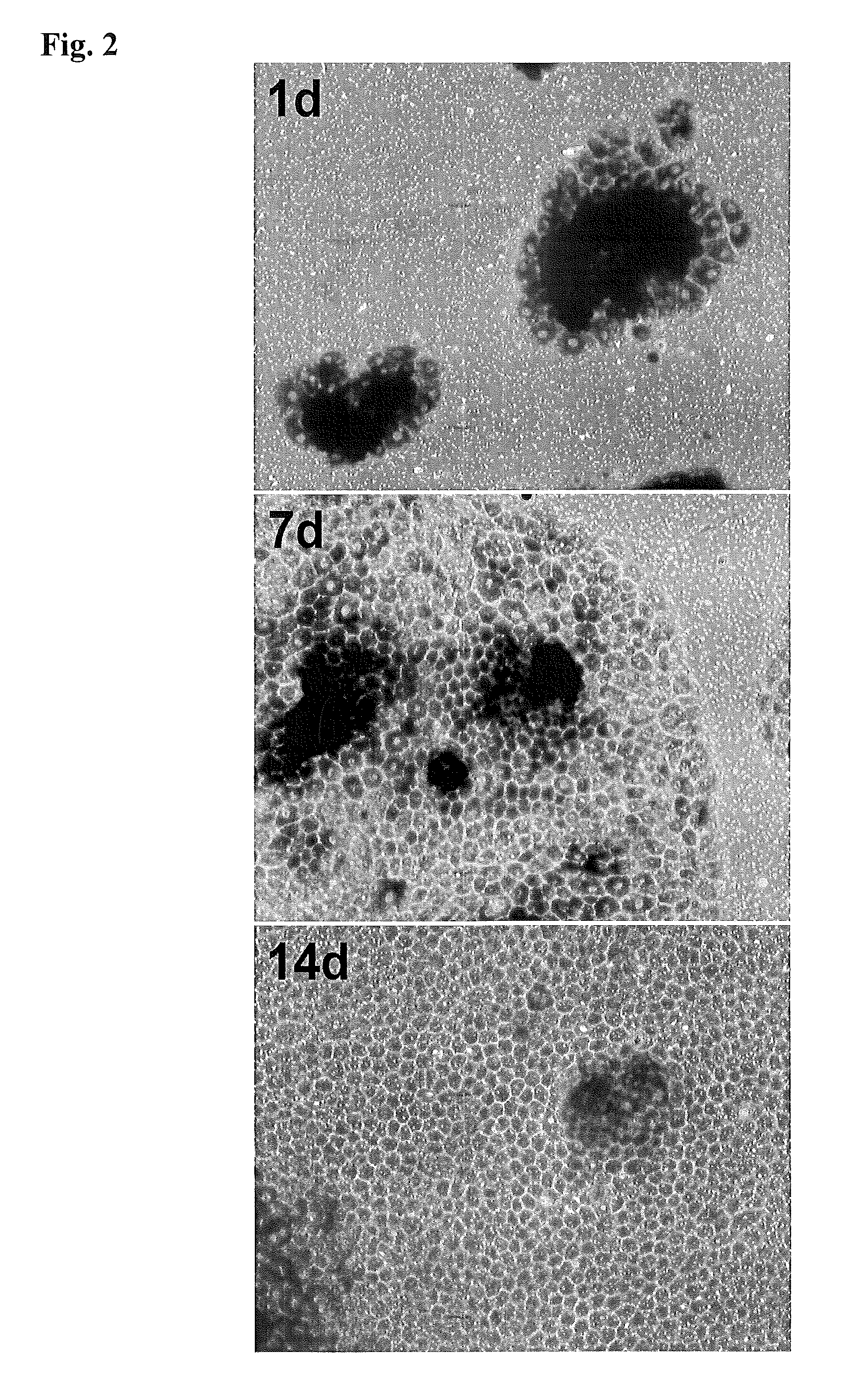 Retinal pigment epithelial primary cell culture system producing subcellular deposits